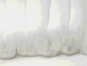 Filter Wool (Esponja blanca)