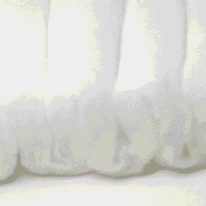 Filter Wool (Esponja blanca)